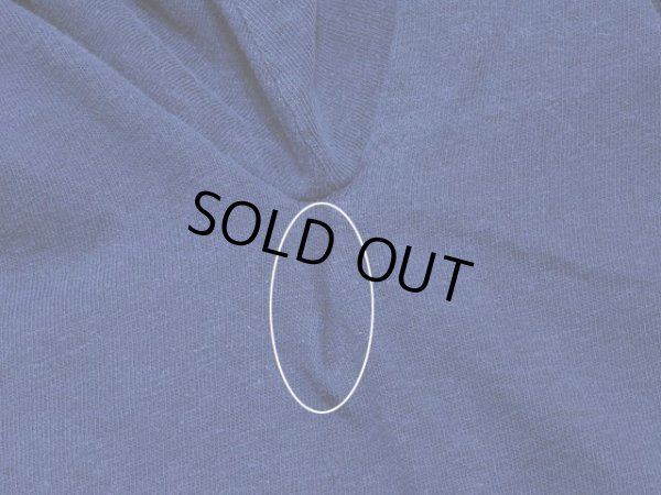 右脇の下のリペア跡