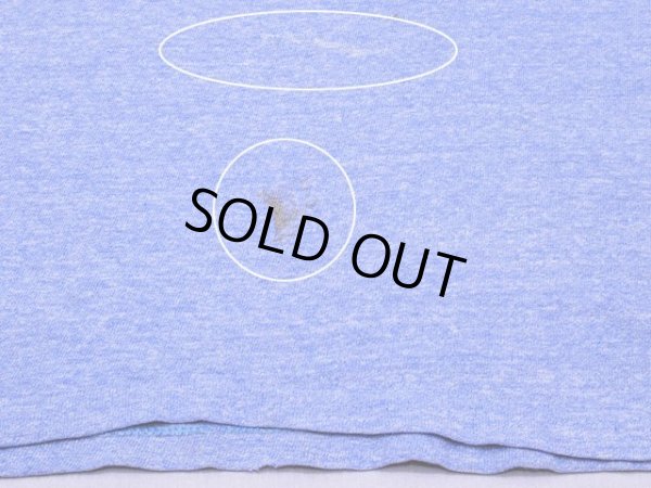 お腹付近の汚れ