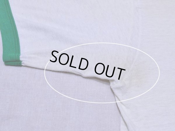 右脇の下に薄らシミ