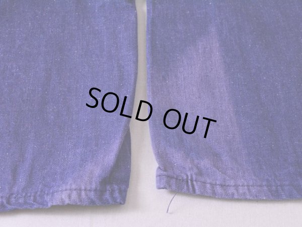 両足裾に日焼け。