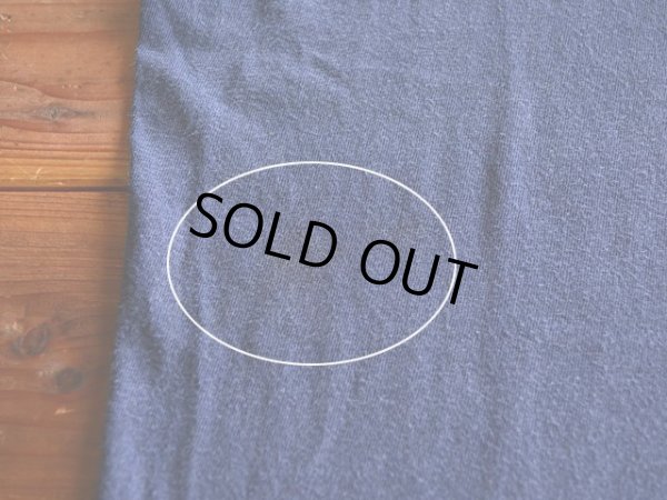 右脇腹に薄らシミ。