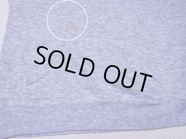 お腹に薄らシミ