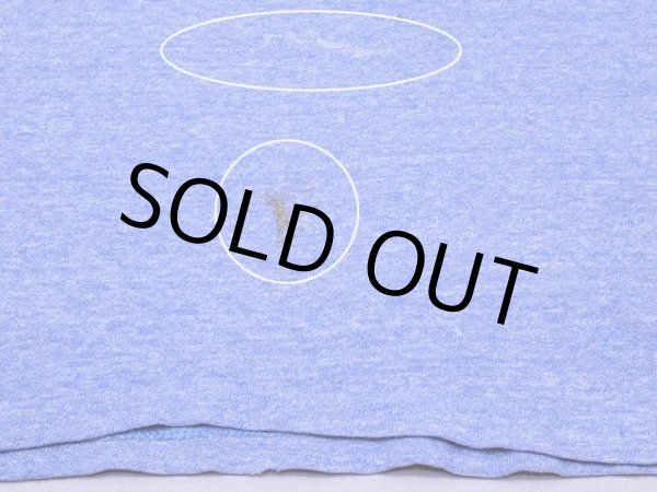 お腹付近の汚れ