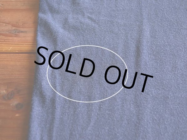 右脇腹に薄らシミ。